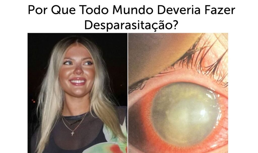 Todo Mundo Deveria Fazer Desparasitação